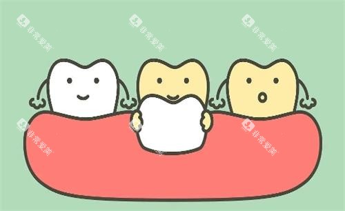 瓷贴面美白牙齿动画展示图