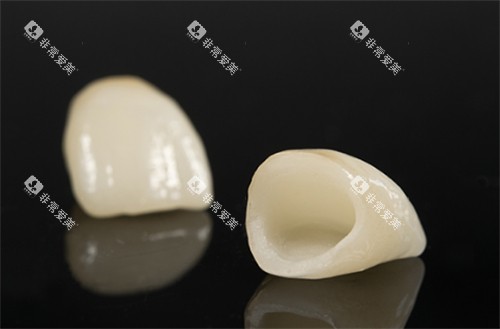 全瓷牙套