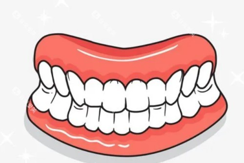 牙齿模型卡通图