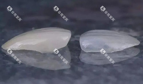 瓷贴面修复对比