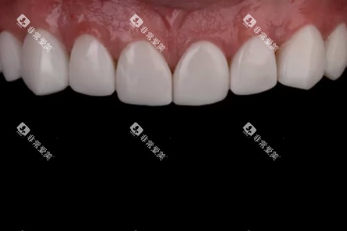 牙齿护理宣传图