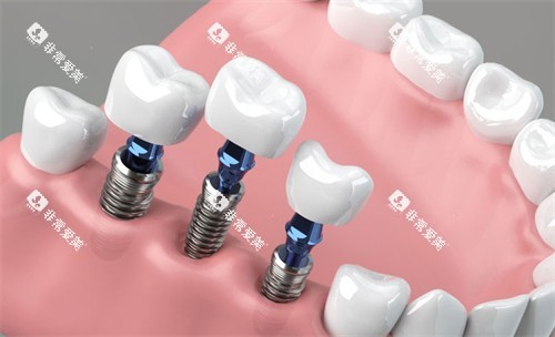 1745397265679356.jpg 1745397264255700.jpg