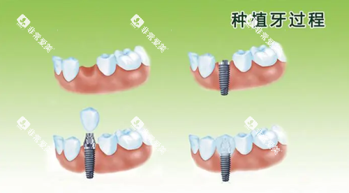 1745397269681755.png 1745397268452210.png