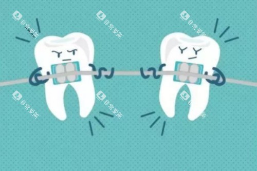 牙齿矫正卡通图