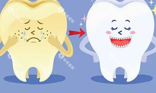 牙齿美白对比图 牙齿美白对比图