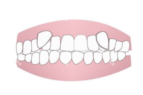 虎牙卡通图 虎牙卡通图