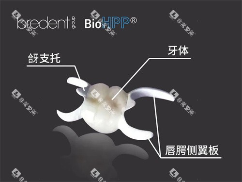hpp粘接桥结构展示图