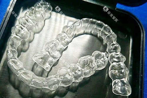 杭州名一口腔牙套实拍图