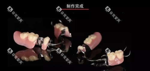 维他灵支架展示图