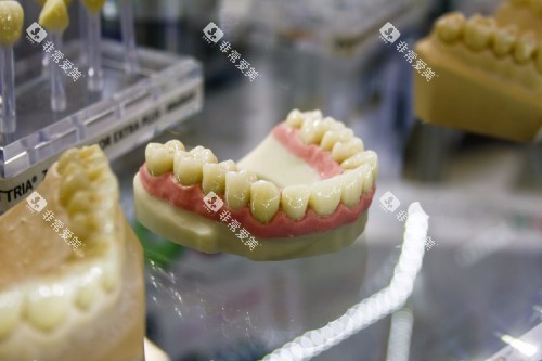 假牙材料展示