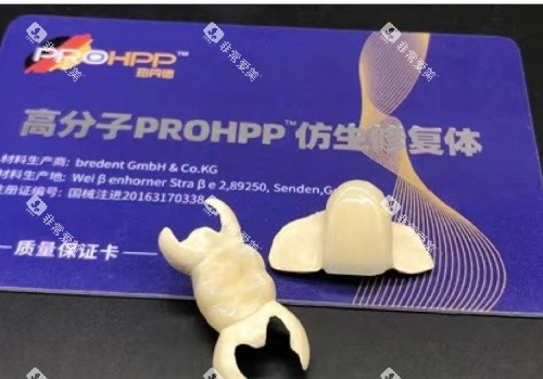 hpp粘接桥牙齿单颗示意图