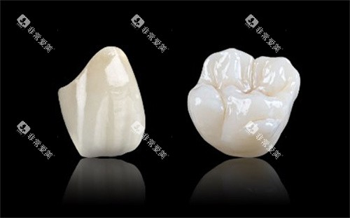 格莱美全瓷
