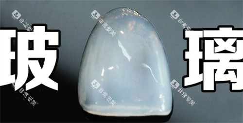 玻璃瓷贴面