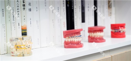 牙套模型图展示