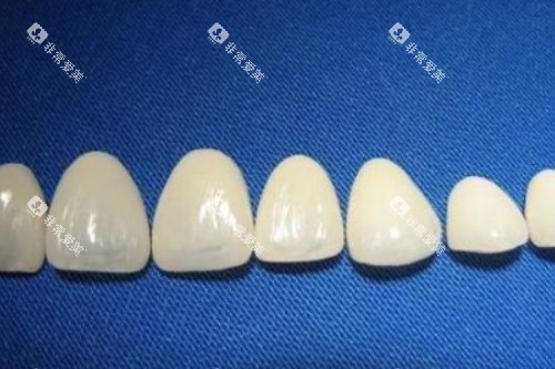 烤瓷牙冠卡通展示图