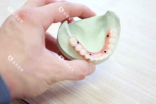 牙科材料展示