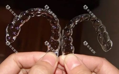 隐形牙套图片