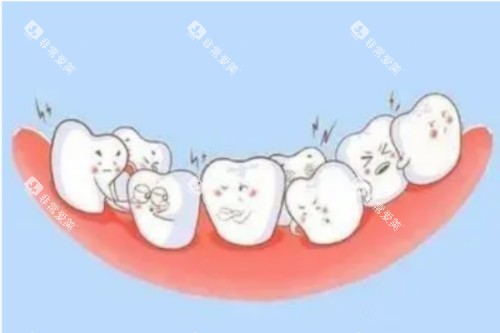 牙齿畸形卡通图