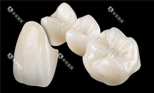 lava全瓷牙牙冠展示