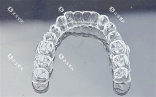 可丽尔隐形矫正牙套