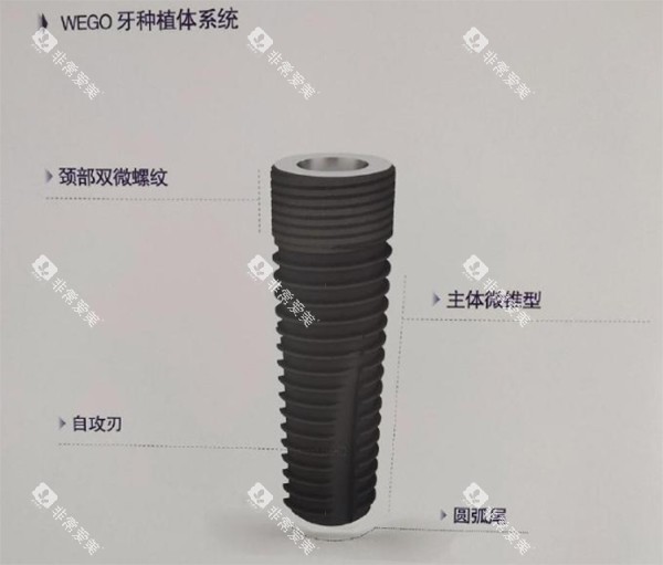 威高wego种植牙颈部双位螺纹细节照片
