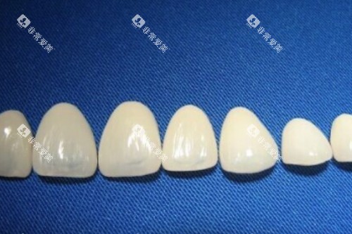 牙冠卡通模型图