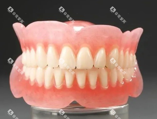 全口假牙示意图 全口假牙示意图