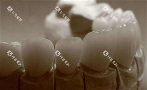 牙齿修复改善照片展示