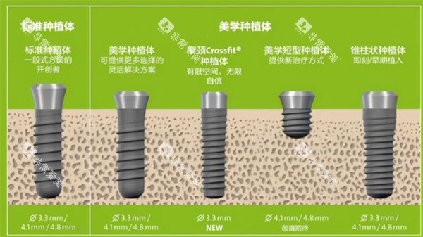种植体规格种类参考图