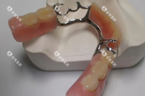 活动假牙模型图片展示