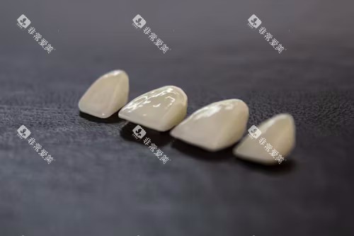 牙冠展示图
