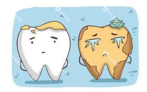 需要清洁的牙齿卡通示意图