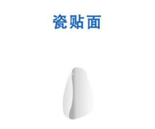 瓷贴面修复改善图