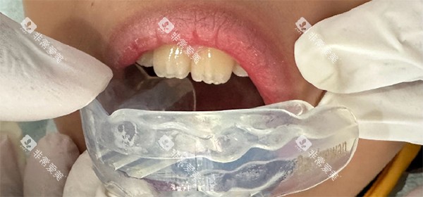 罗慕牙齿矫正 罗慕牙齿矫正