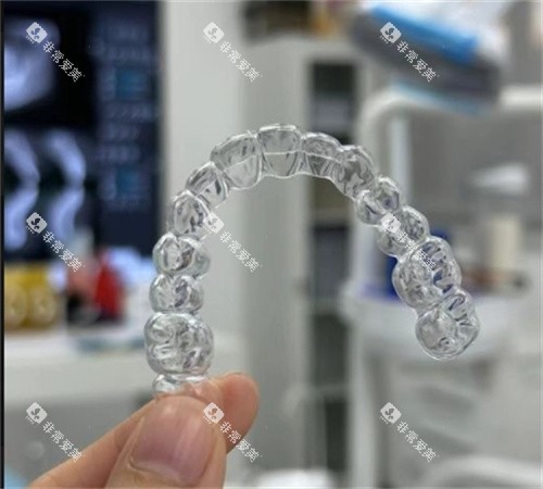 隐形牙套细节照片 隐形牙套细节照片