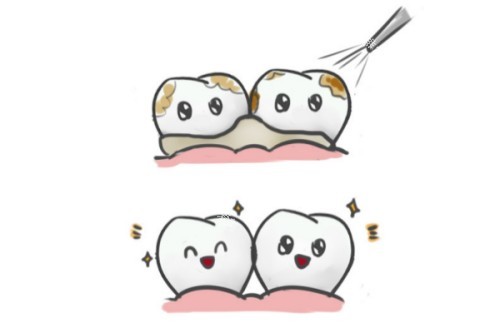 洗牙卡通图