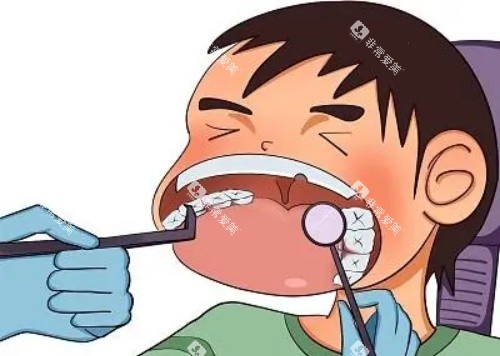 儿童口腔治疗