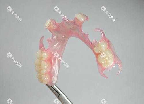 半口活动假牙展示 半口活动假牙展示