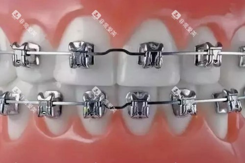 金属矫正卡通模型图