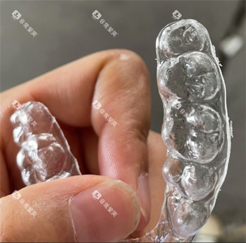 正雅隐形牙套 正雅隐形牙套