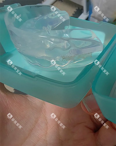 罗慕牙齿矫治器