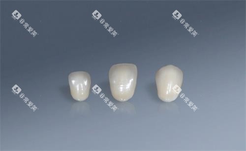 蓝瓷示意图
