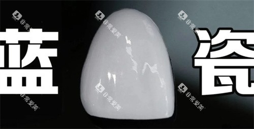 蓝瓷贴面