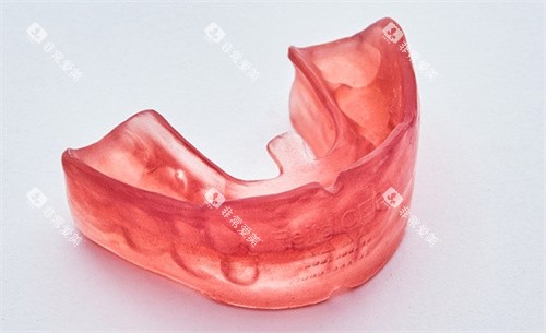 oer矫治器 oer矫治器