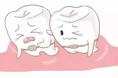 牙齿矫正卡通