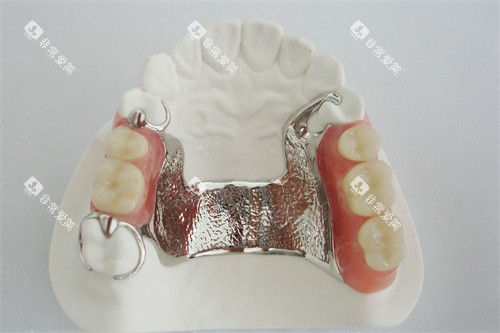 维他灵活动义齿成品 维他灵活动义齿成品