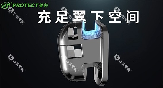 普特牙套的优势分析