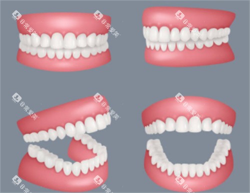 假牙各个角度