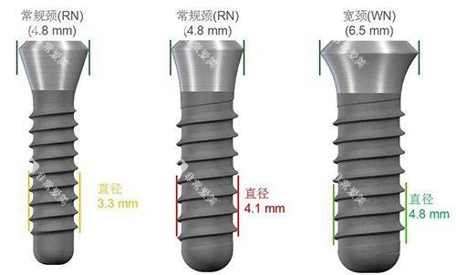 种植牙尺寸规格种类图