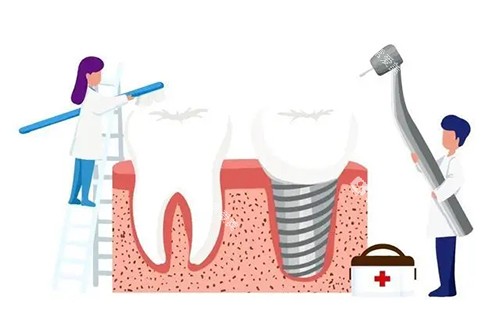 牙齿清洁维护卡通示意图 牙齿清洁维护卡通示意图